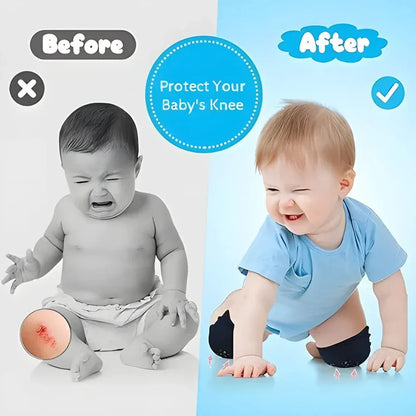 2 Pair Baby Knee Pads for Crawling | Anti-Slip Safety Knee Protectors for Infants